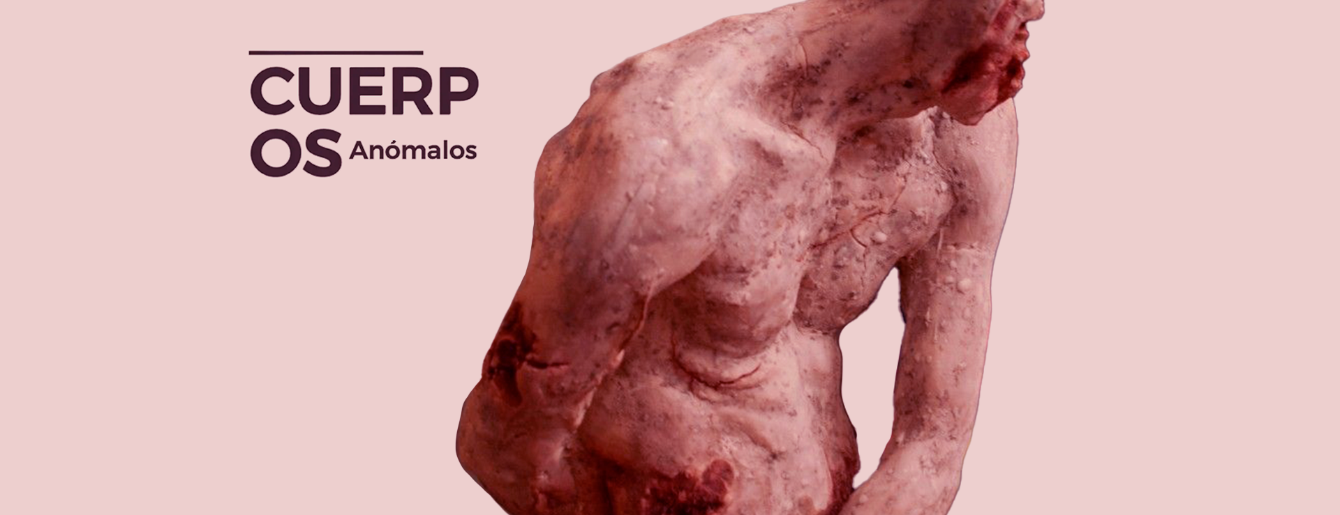 CUERPOS ANÓMALOS